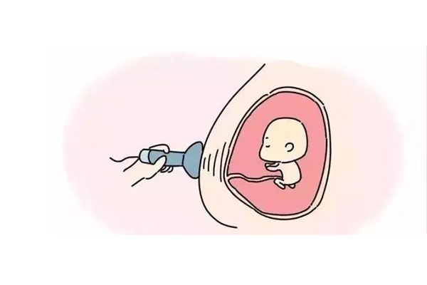 nt值为3.7mm也可正常生育