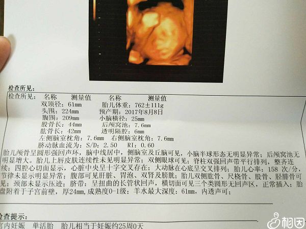 孕中期四维彩超的首要检查项目
