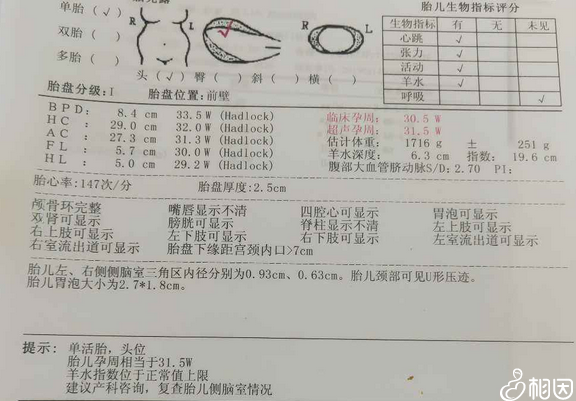 30周二维小排畸