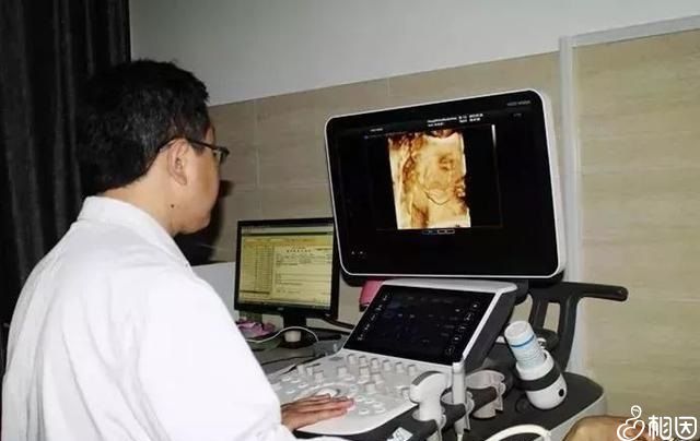 b超检查观察胎儿