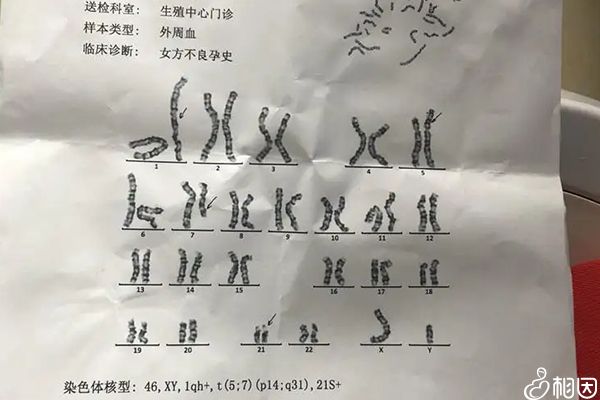 无创dna适用人群