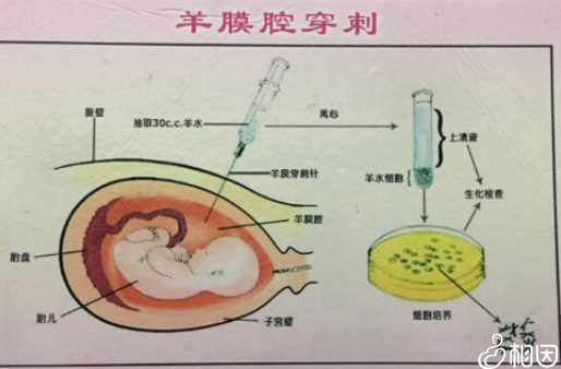 取样的部位不同