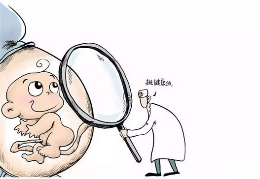 整个绒穿检查过程多久