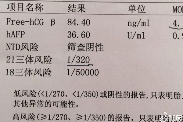 某唐筛检查结果报告单