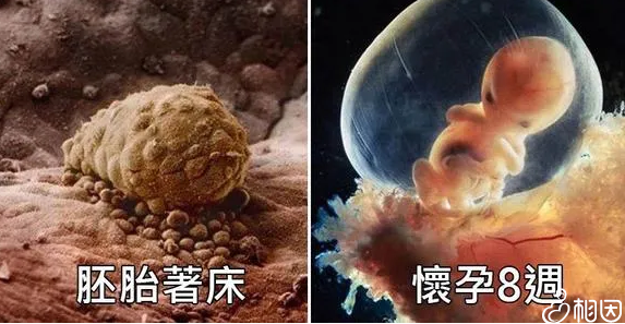 怀孕出血可能是先兆性流产