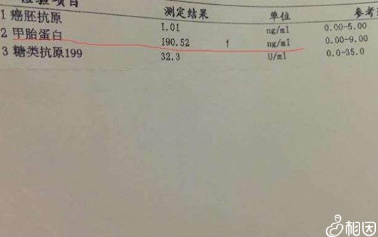 为什么检查甲胎蛋白
