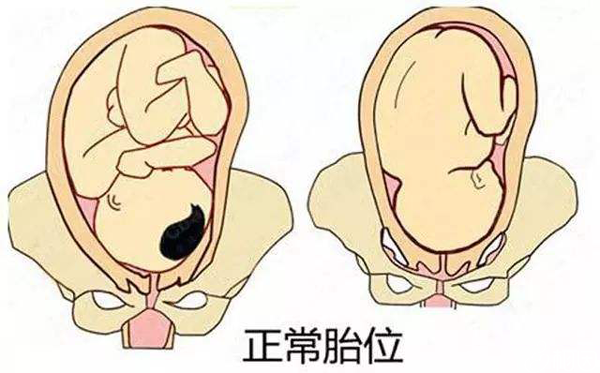 胎位检查