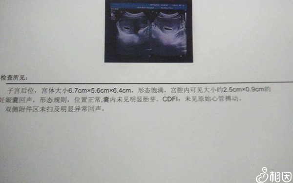 停经怀孕b超检查