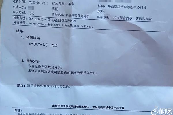 检查项目会影响羊水穿刺费用