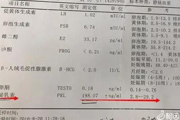 催乳素正常参考值