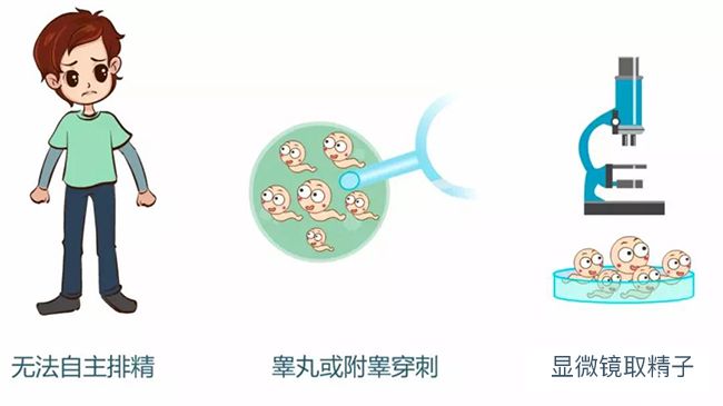取精