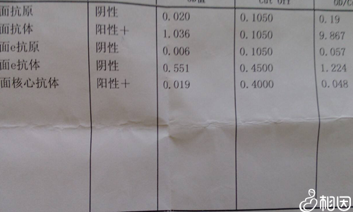 乙肝五项检查其中第二项以及第五项阳性属于正常情况