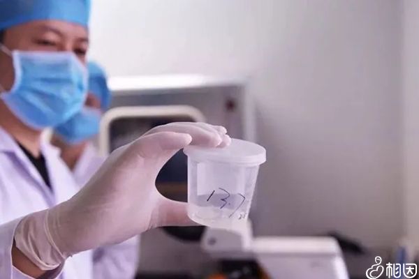 捐精有年龄限制