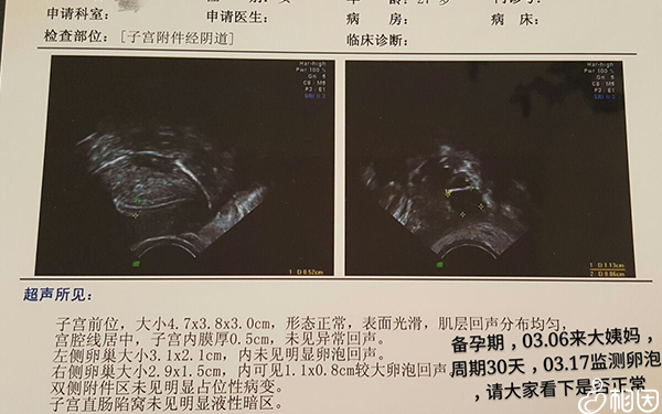 b超检查
