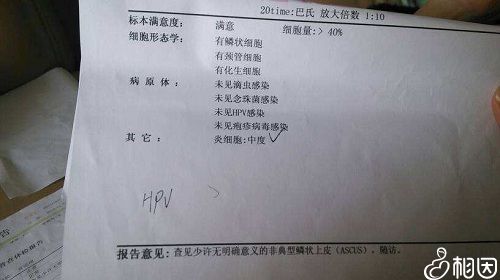 tct检查结果有几种