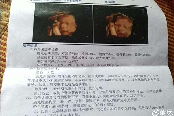 医院彩超检查单