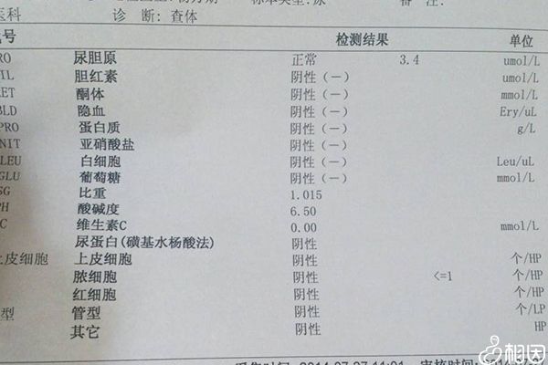 霉菌检查结果阴性