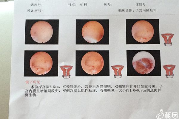 宫腔镜检查费用不低