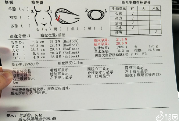 小排畸检查报告单