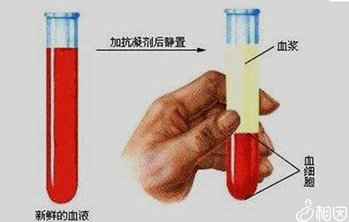 血沉检查的方法