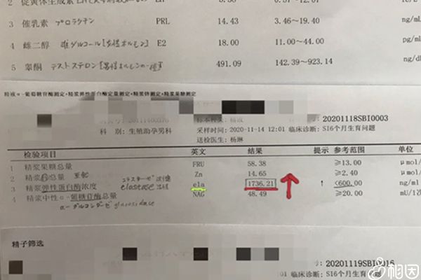 精浆生化报告单