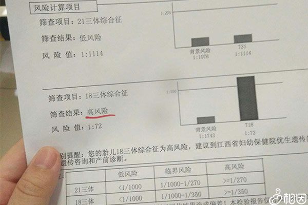 某早唐筛高风险报告单