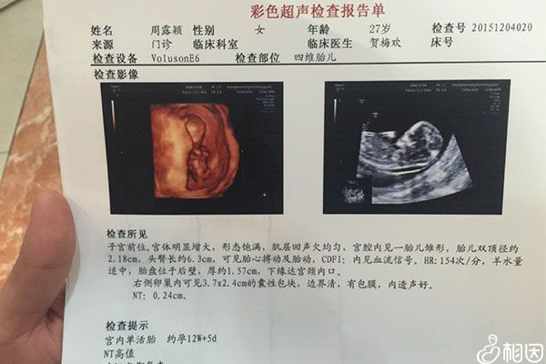 某nt检查结果偏高报告单