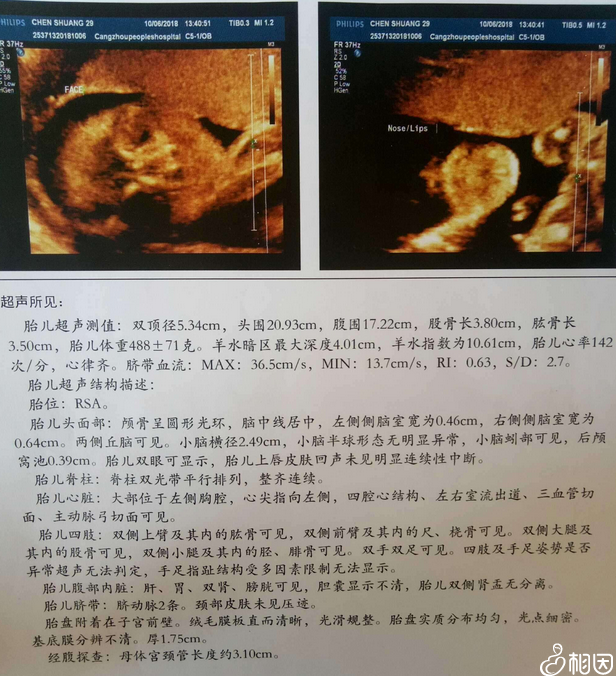 孕期小排畸检查