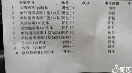 巨细胞病毒igG