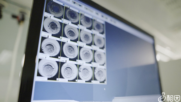 养囊成功率有多少