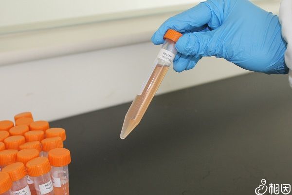 酶联免疫分析法的优点