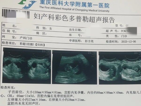 怀孕建档得提前备好资料