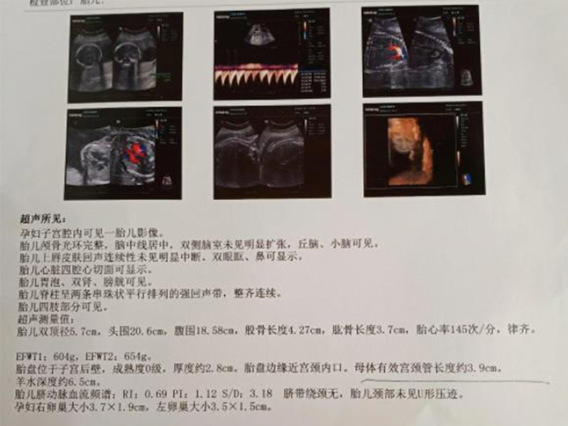 ed319dd58a119079c0c92187cd7084b5.jpg