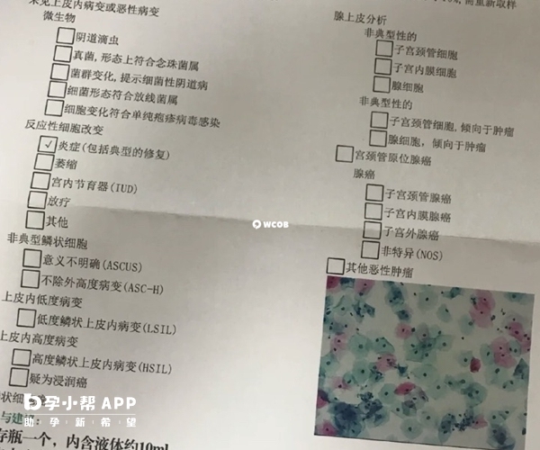 tct检查报告单