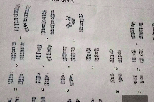 孕妇染色体检查费在3千左右