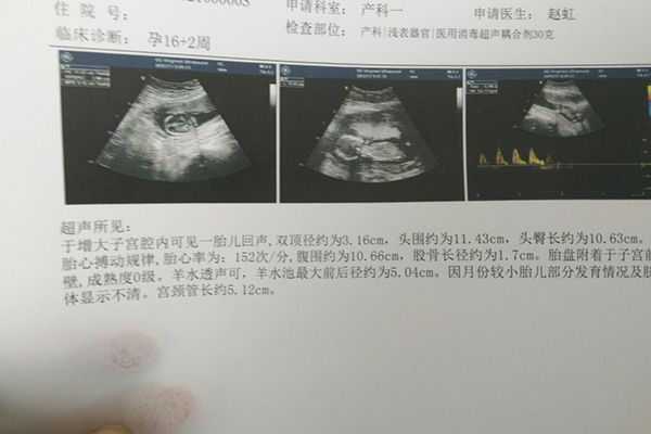 着床位置不能预测生男生女