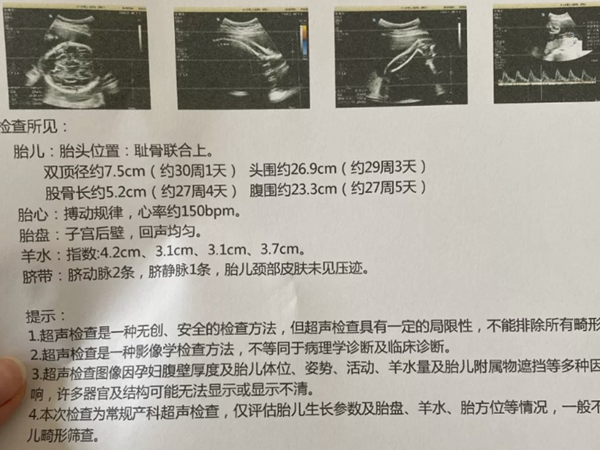 胎位检查表
