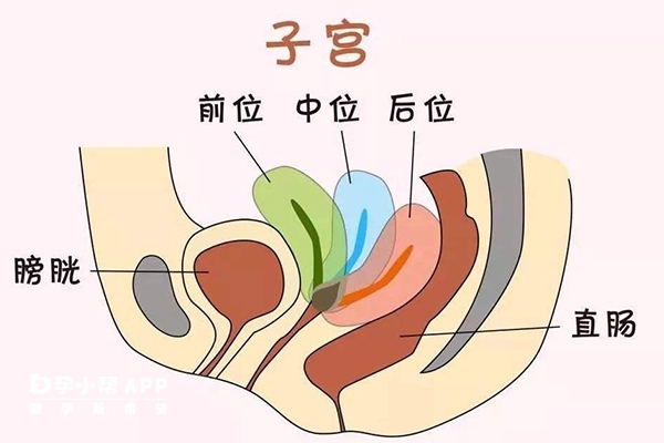 子宫后位可能是病理因素所致