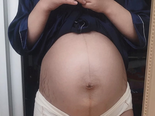 孕期尿液发黄能看出肾脏问题