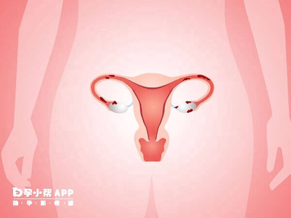 卵巢性不孕跟一些疾病有关