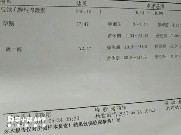 过早检查hcg会不准
