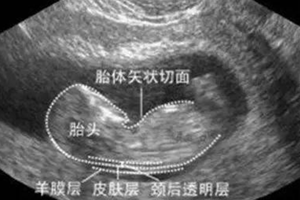 胎体矢状切面图