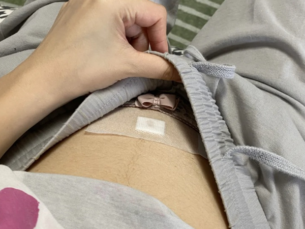 胎儿畸形16周的时候可以查出来