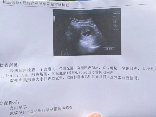 胚芽发育慢可能是激素不足