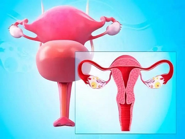 试管前女士是否做造影检查因人而异