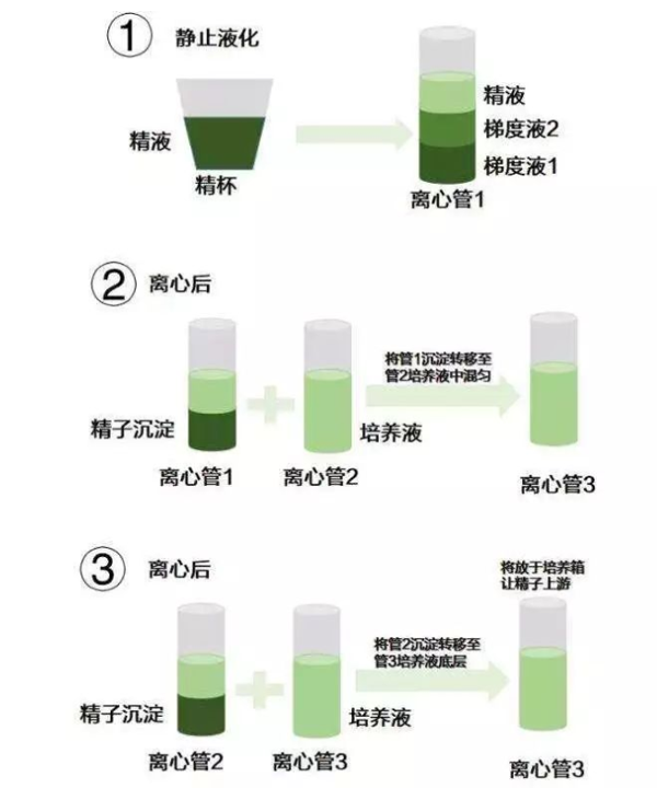 HIV洗精术流程
