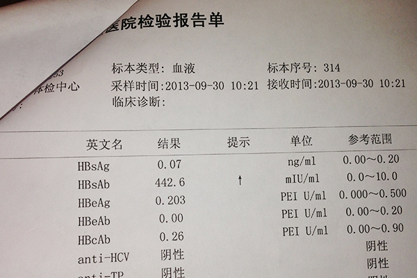 做试管出检查结果很快