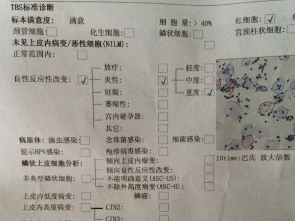 子宫颈抹片筛查报告单