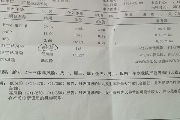 检查结果提示21三体高风险