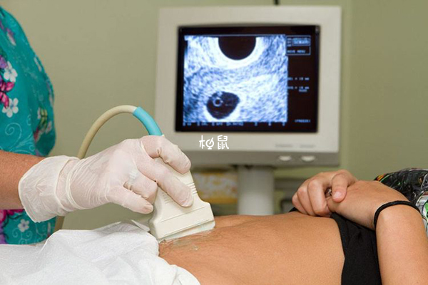 超声检查前可以多喝水